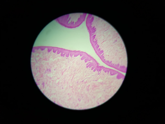 Stratified Squamous Epithelium Slides - Stratified Squamous Epithelium 01 100X
